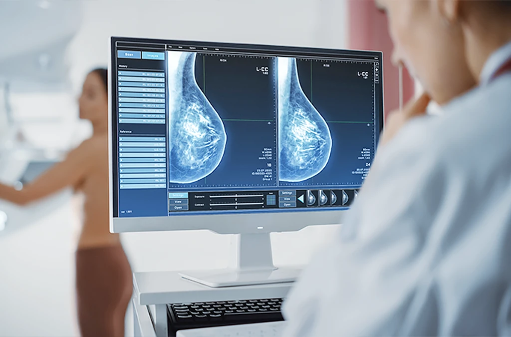 Eine Frau, die im Hintergrund eine Mammographie macht und eine Ärztin, die die Ergebnisse auf einem Bildschirm ansieht